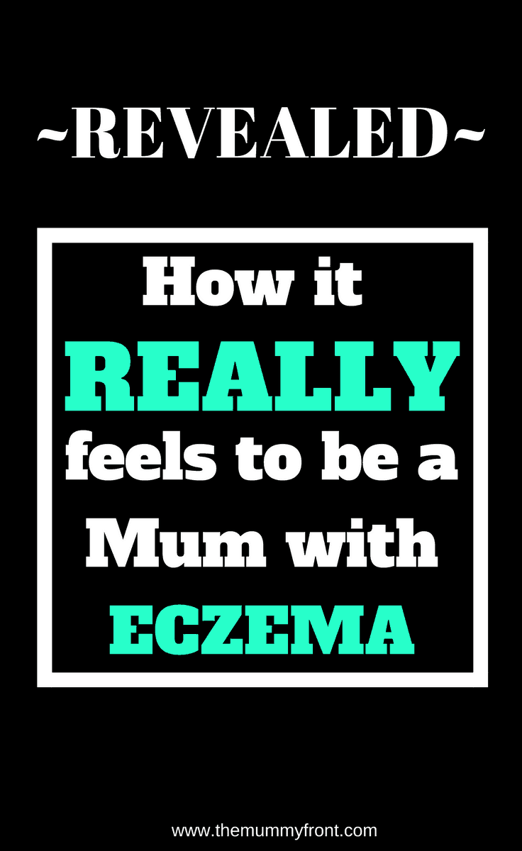 A Letter To The Mum Who Suffers With Eczema | Eczema Support | Mums with Eczema